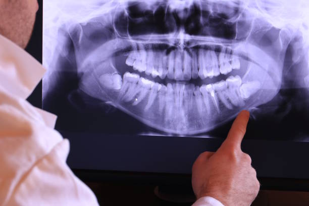 Best Holiday Emergency Dentist in Clear Lake Shores, TX
