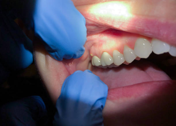 Best Emergency Cosmetic Dentistry in Clear Lake Shores, TX